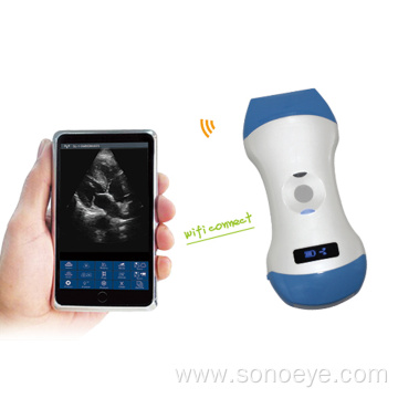Wireless Pocket Ultrasound for iOS & Android